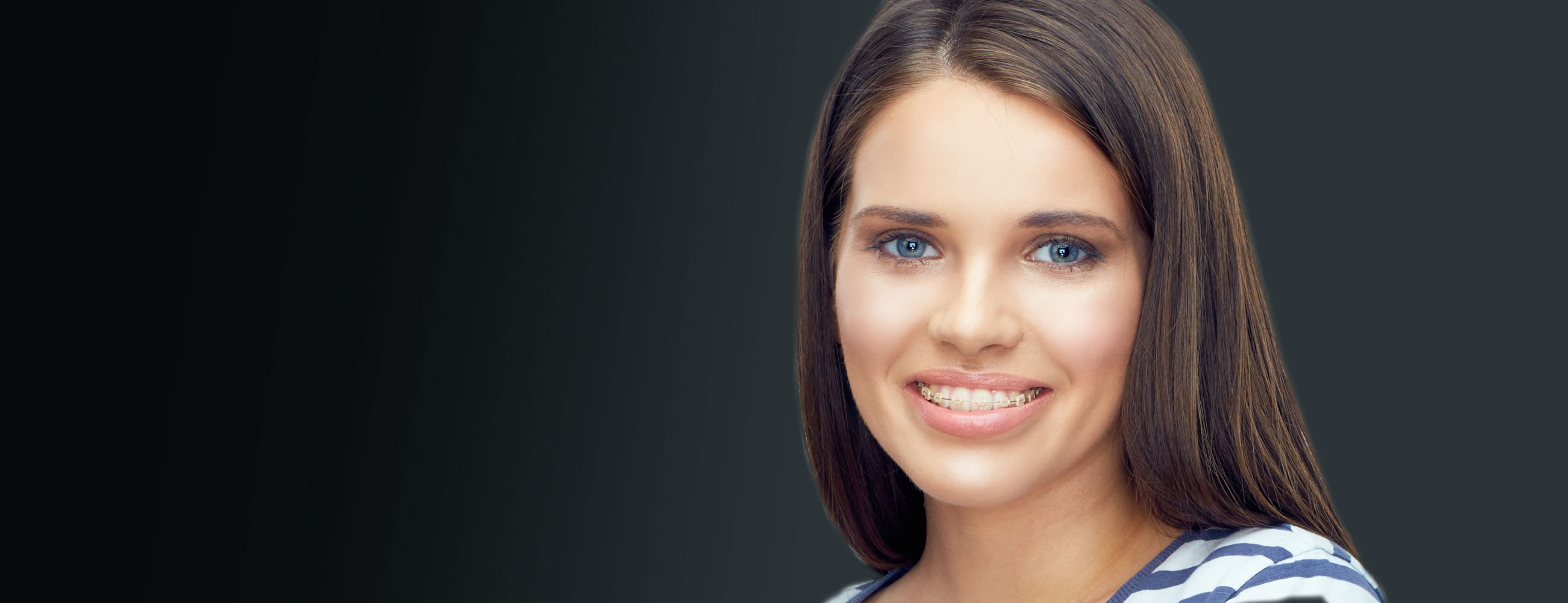Discreet White Braces in Dumfries