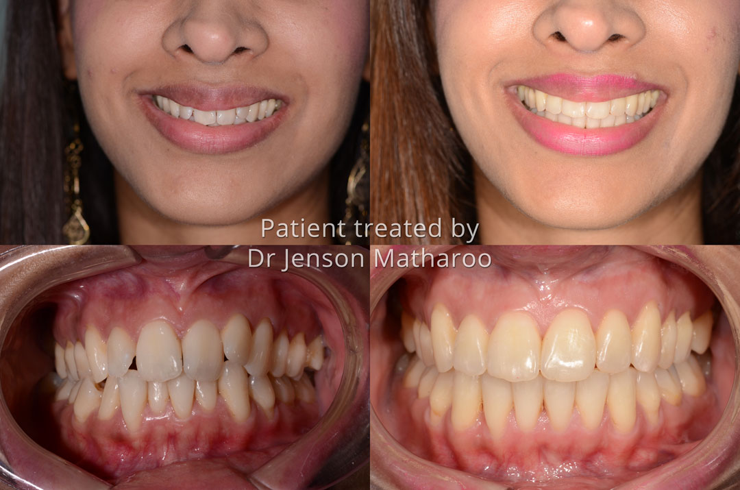 G testimonial for Dumfries Orthodontics